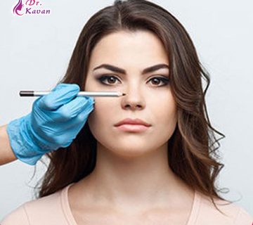عمل زیبایی بینی به روش بسته