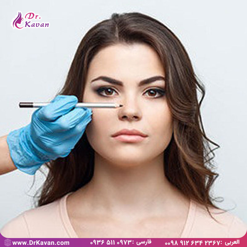 عمل زیبایی بینی به روش بسته