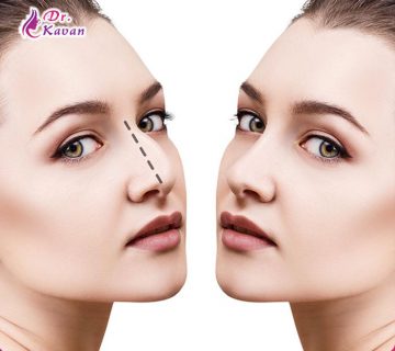 جراحی زیبایی بینی