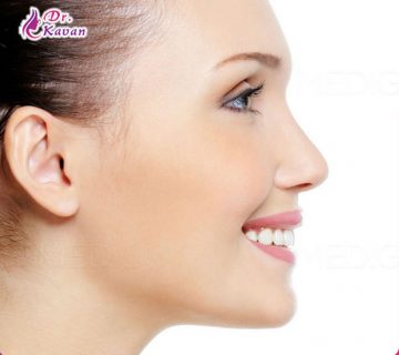 هزینه عمل بینی طبیعی