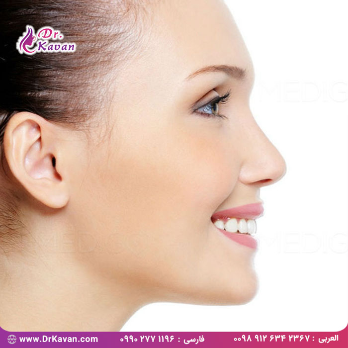 هزینه عمل بینی طبیعی