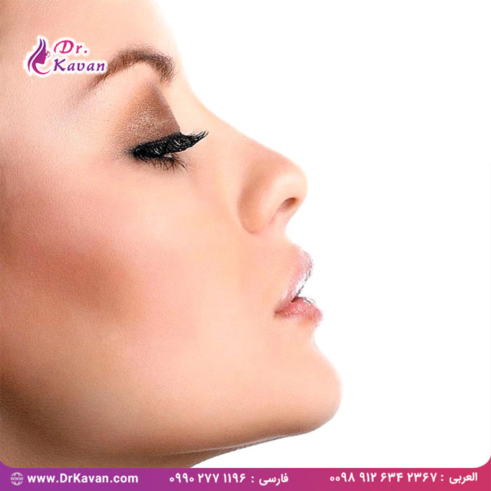 بایدها و نبایدها بعد از رینوپلاستی