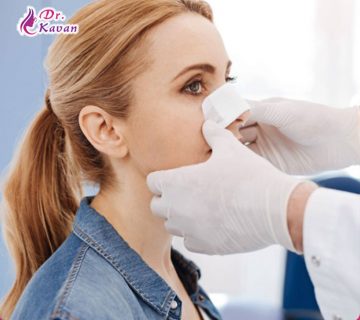 10 عاملی که باید بعد از عمل جراحی زیبایی بینی از آن ها خودداری کنید