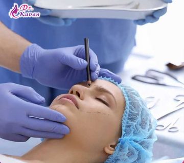 چه نوع بیهوشی برای عمل بینی مناسب است؟