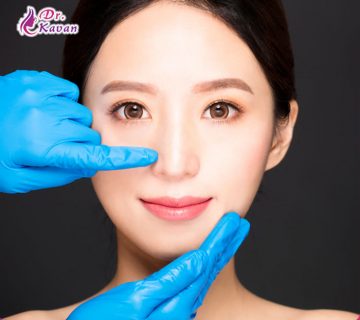 همه چیز درباره آلارپلاستی