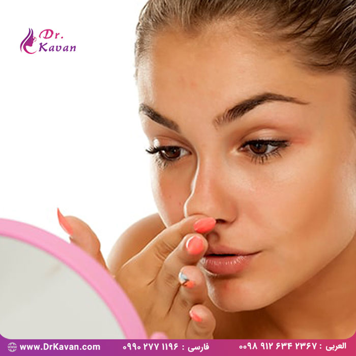 تغییر شکل بینی