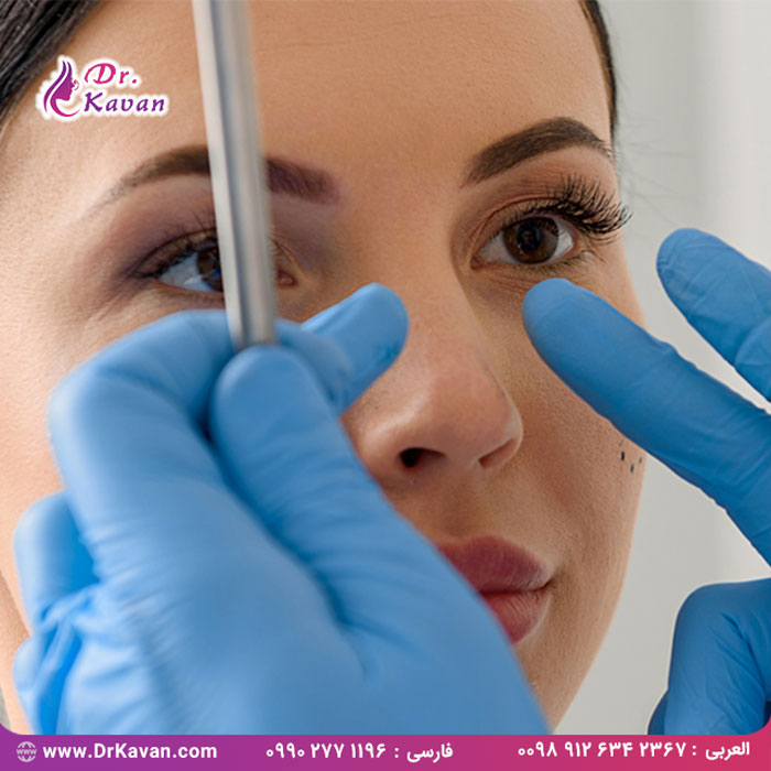 انواع عمل بینی