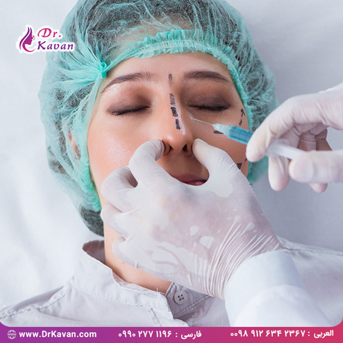 تزریق فیلر بینی