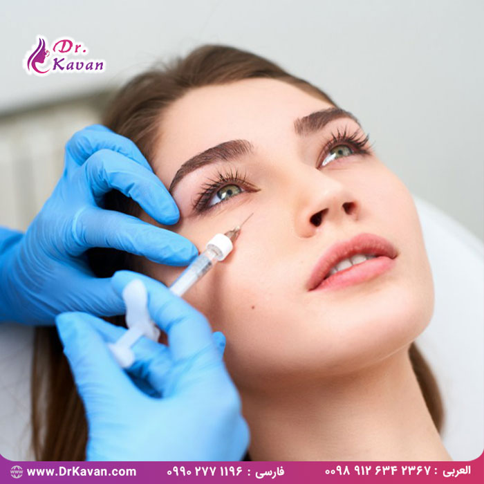 همه چیز درباره فیلر زیر چشم