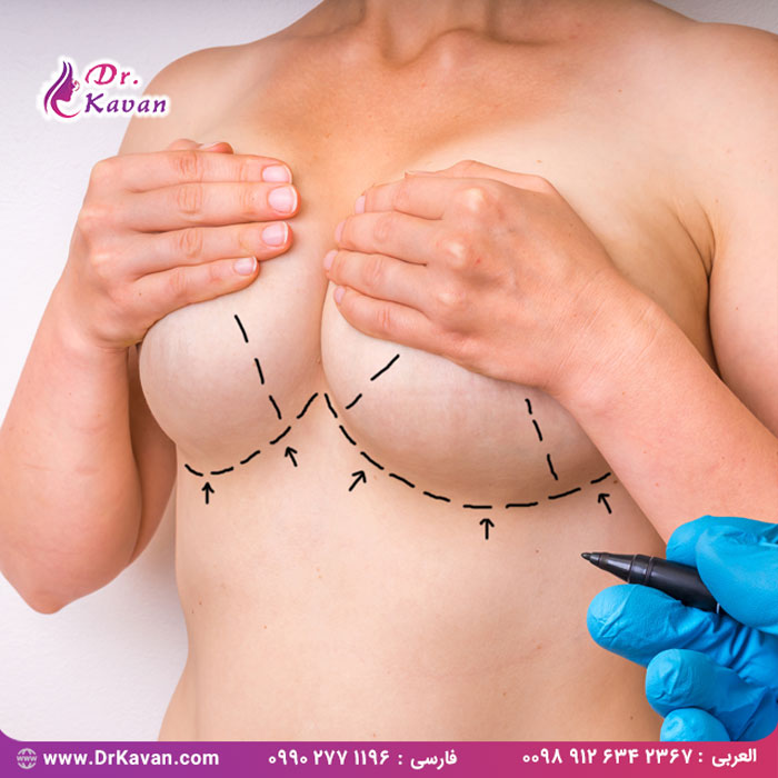 هشت نوع عمل جراحی زیبایی متداول