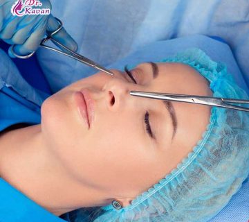 جراحی عملکردی بینی