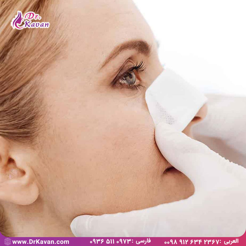 تورم بعد از عمل بینی