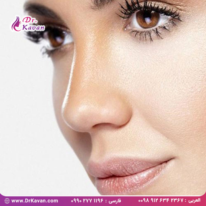 جراحی زیبایی بینی