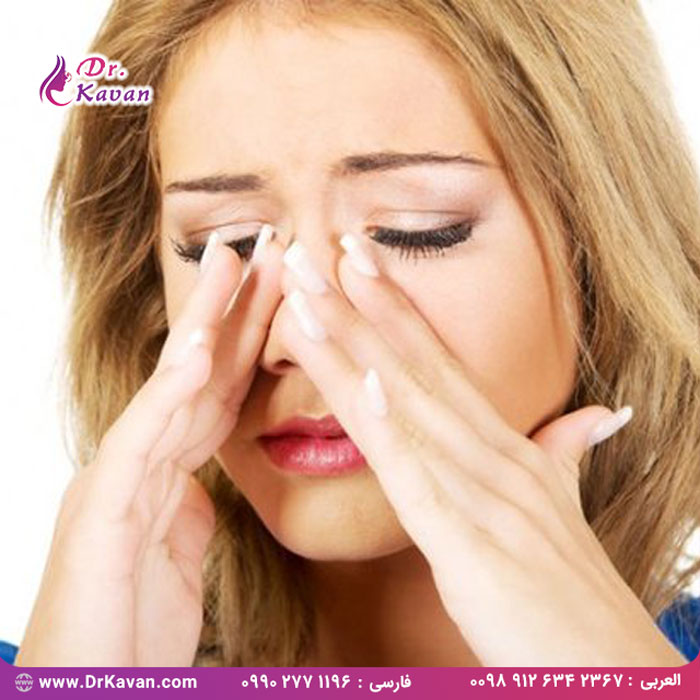 انسداد بینی و احتقان بینی