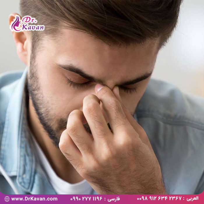 علل و چگونگی درمان درد پل بینی