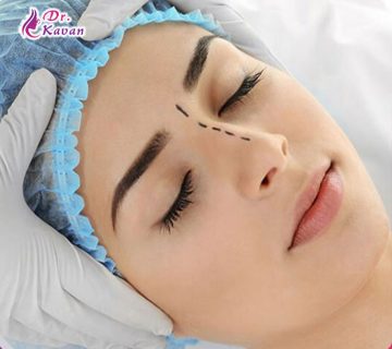 جراحی بینی چگونه تمام اجزای چهره فرد را تحت تاثیر قرار می دهد؟