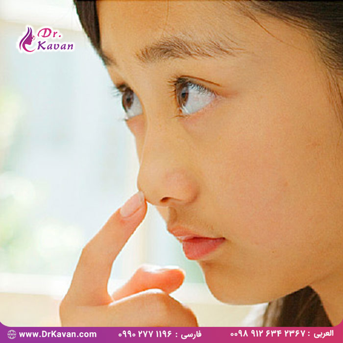 عمل بینی (رینوپلاستی) نوجوانان