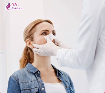 راهنمای انتخاب بهترین جراح بینی