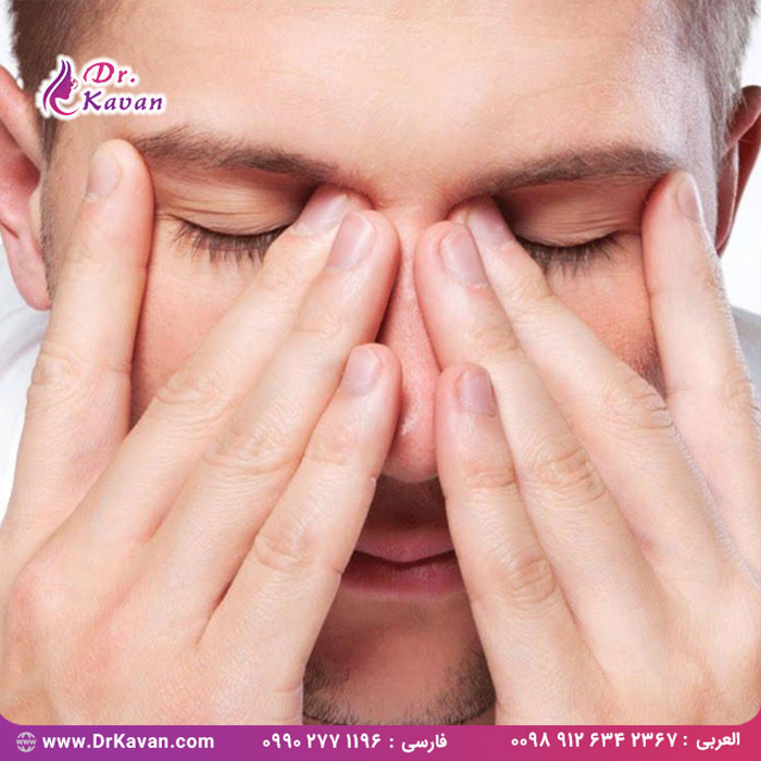 همه چیز در مورد پولیپ بینی