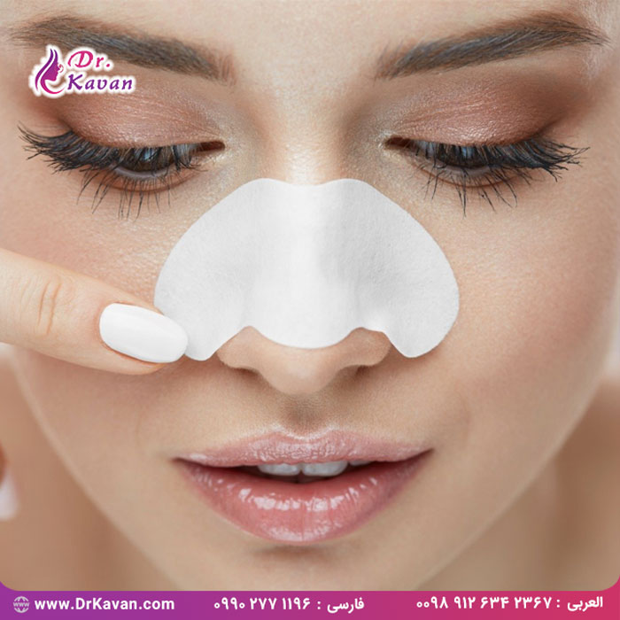 بایدها و نبایدها بعد از رینوپلاستی