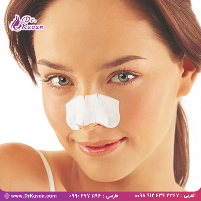 ورزش بعد از عمل بینی