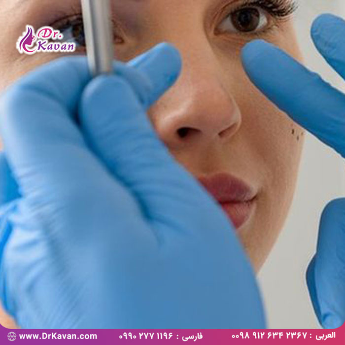 چه نوع بیهوشی برای عمل بینی مناسب است؟