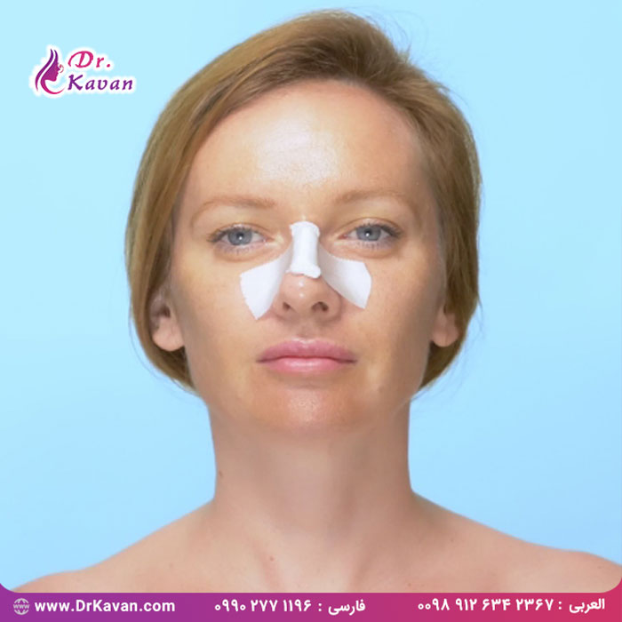 رینوپلاستی درمانی مکمل