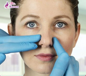 رفع انحراف سپتوم با استفاده از جراحی بینی