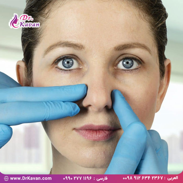 رفع انحراف سپتوم با استفاده از جراحی بینی