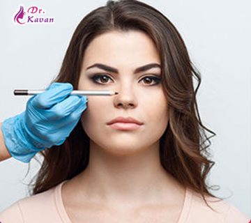 تغییر شکل بینی