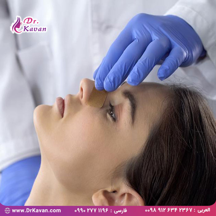 انواع عمل بینی