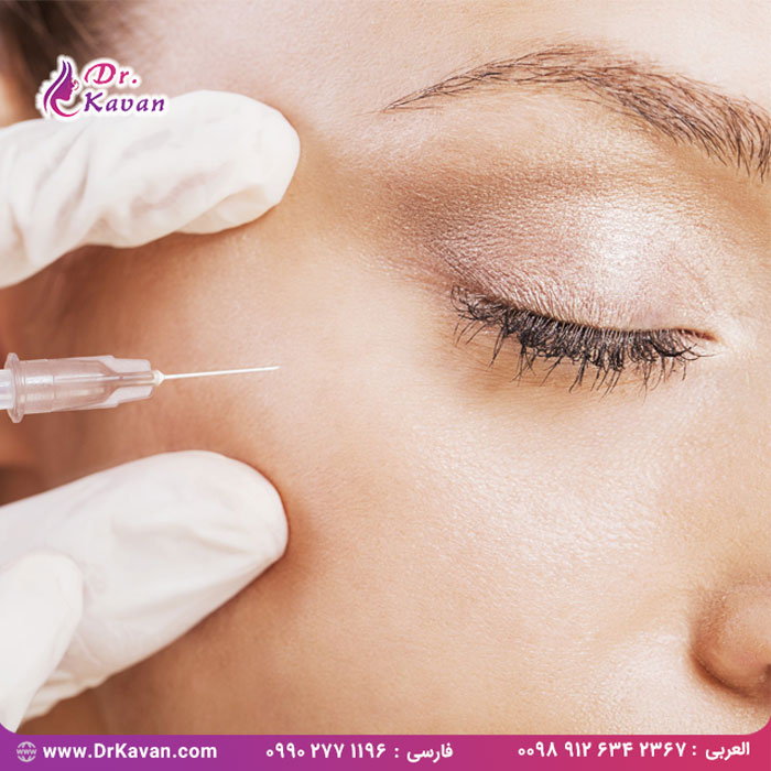 همه چیز درباره فیلر زیر چشم