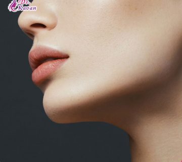 باید ها و نباید ها بعد از عمل بینی