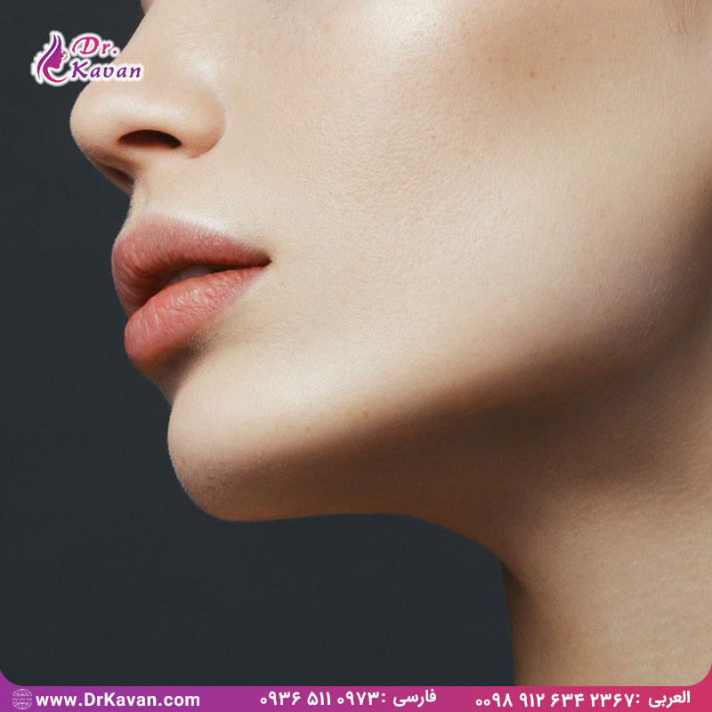 باید ها و نباید ها بعد از عمل بینی