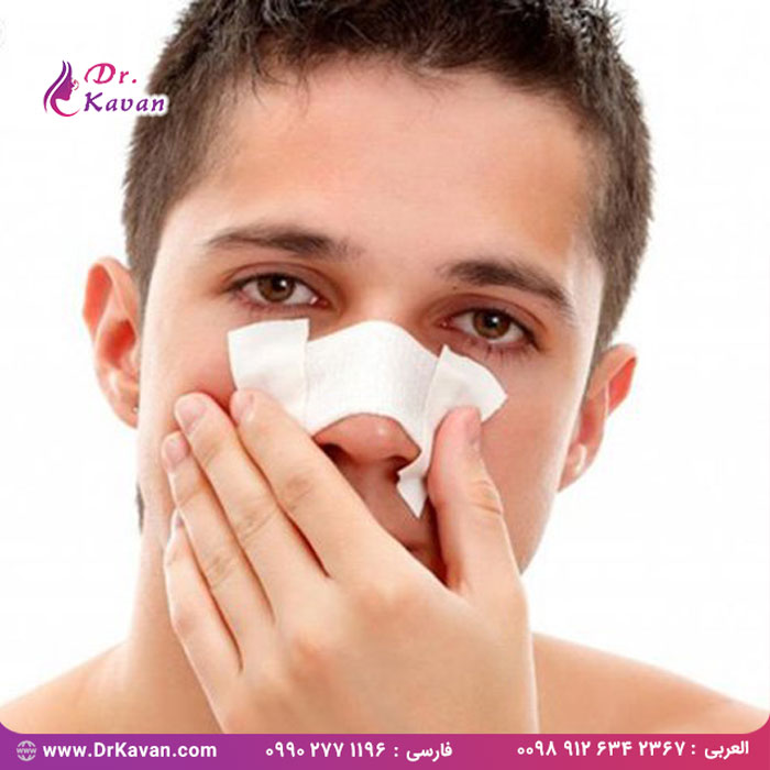 عمل شکستگی بینی