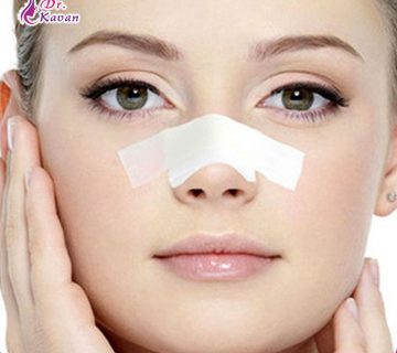 ریکاوری بعد از عمل بینی