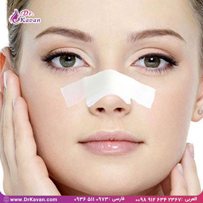 ریکاوری بعد از عمل بینی