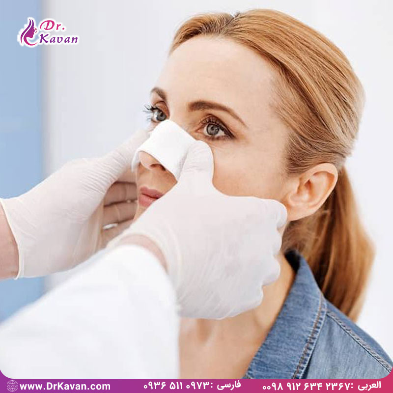 جراحی عملکردی بینی