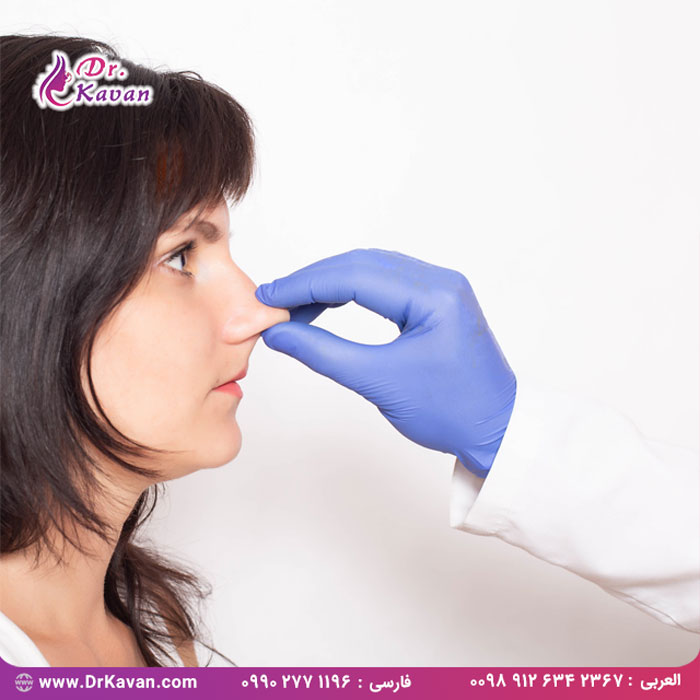 بهترین کاندیدای رینوپلاستی