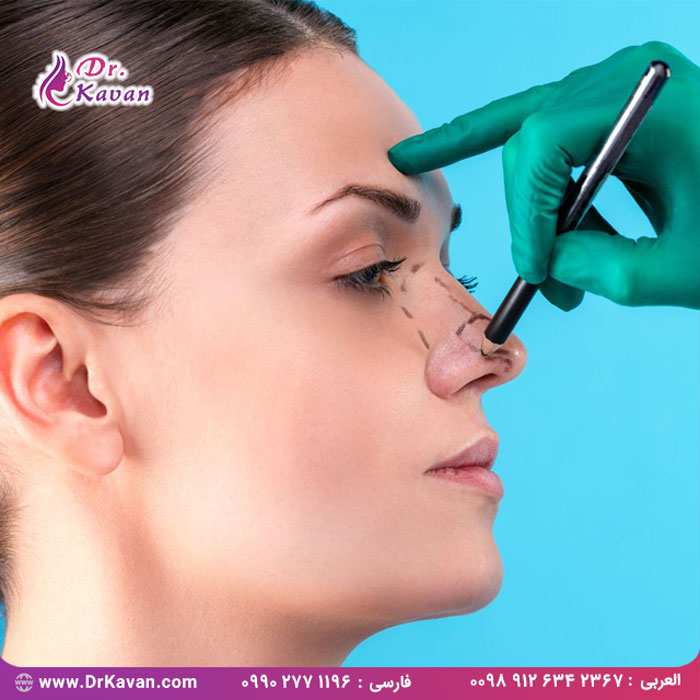 هر آنچه که باید در رابطه با جراحی بینی بدانید