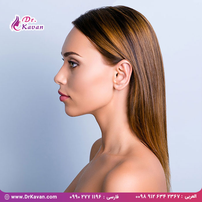 آیا من به عمل بینی نیاز دارم؟