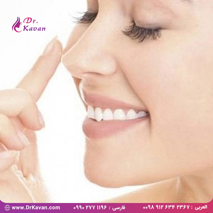 موفقیت در جراحی بینی به چه عواملی بستگی دارد؟