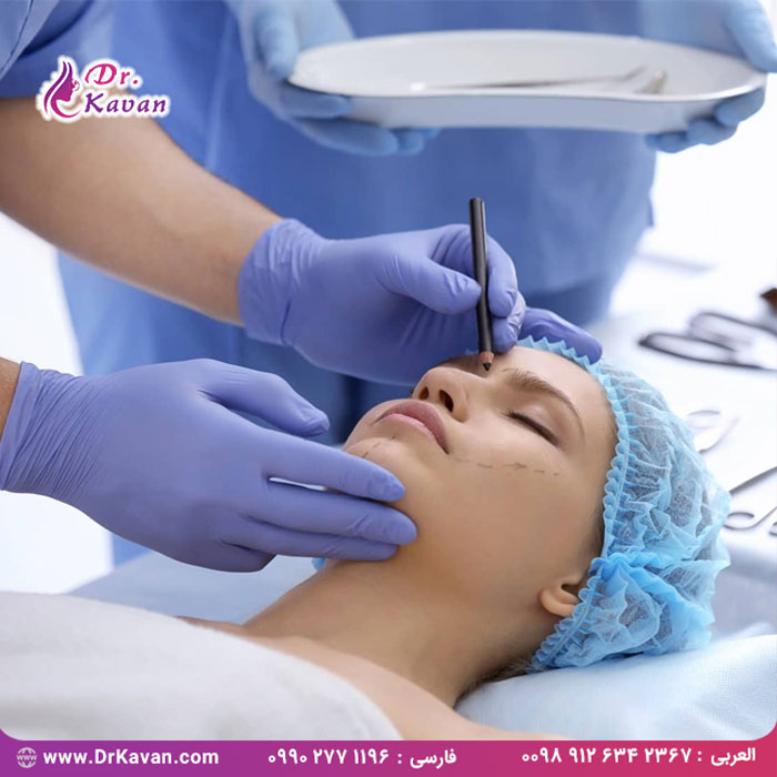 تغییر شکل بینی