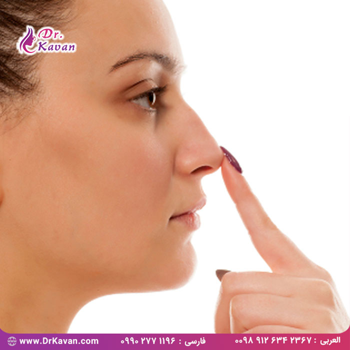 دلایل انتخاب جراحی زیبایی بینی