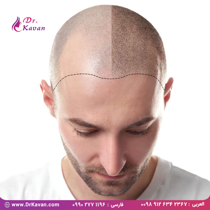 هشت نوع عمل جراحی زیبایی متداول