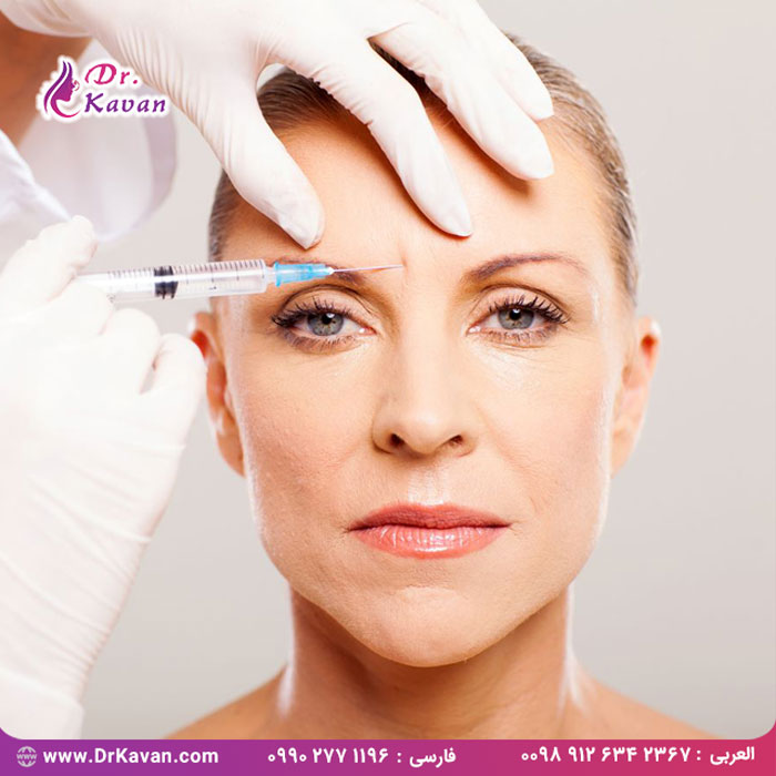 درمان چین و چروک با فیلر و بوتاکس