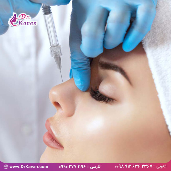 آیا استفاده از فیلر بعد از جراحی زیبایی بینی امکان پذیر است ؟