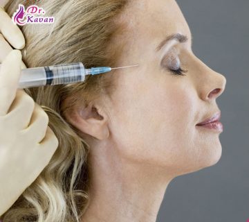 درمان چین و چروک با تزریق فیلر