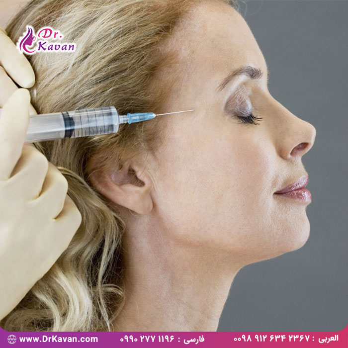 درمان چین و چروک با تزریق فیلر