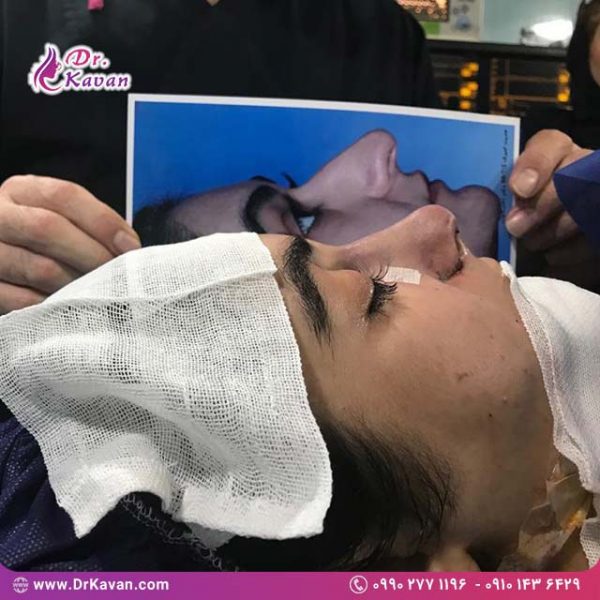 عمل زیبایی بینی